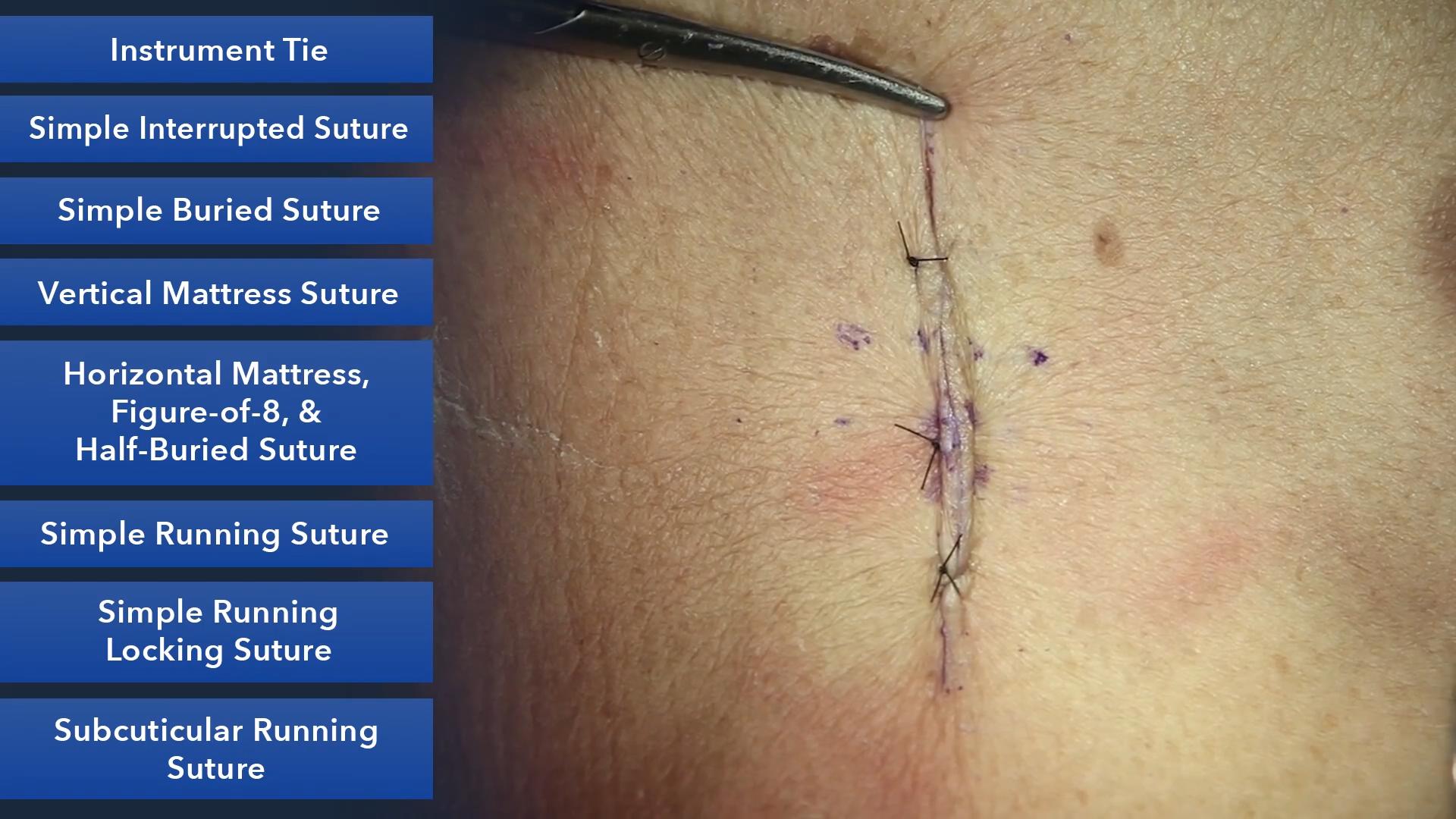 Duke_Suture_Skills_Course_1080p_20210830205454