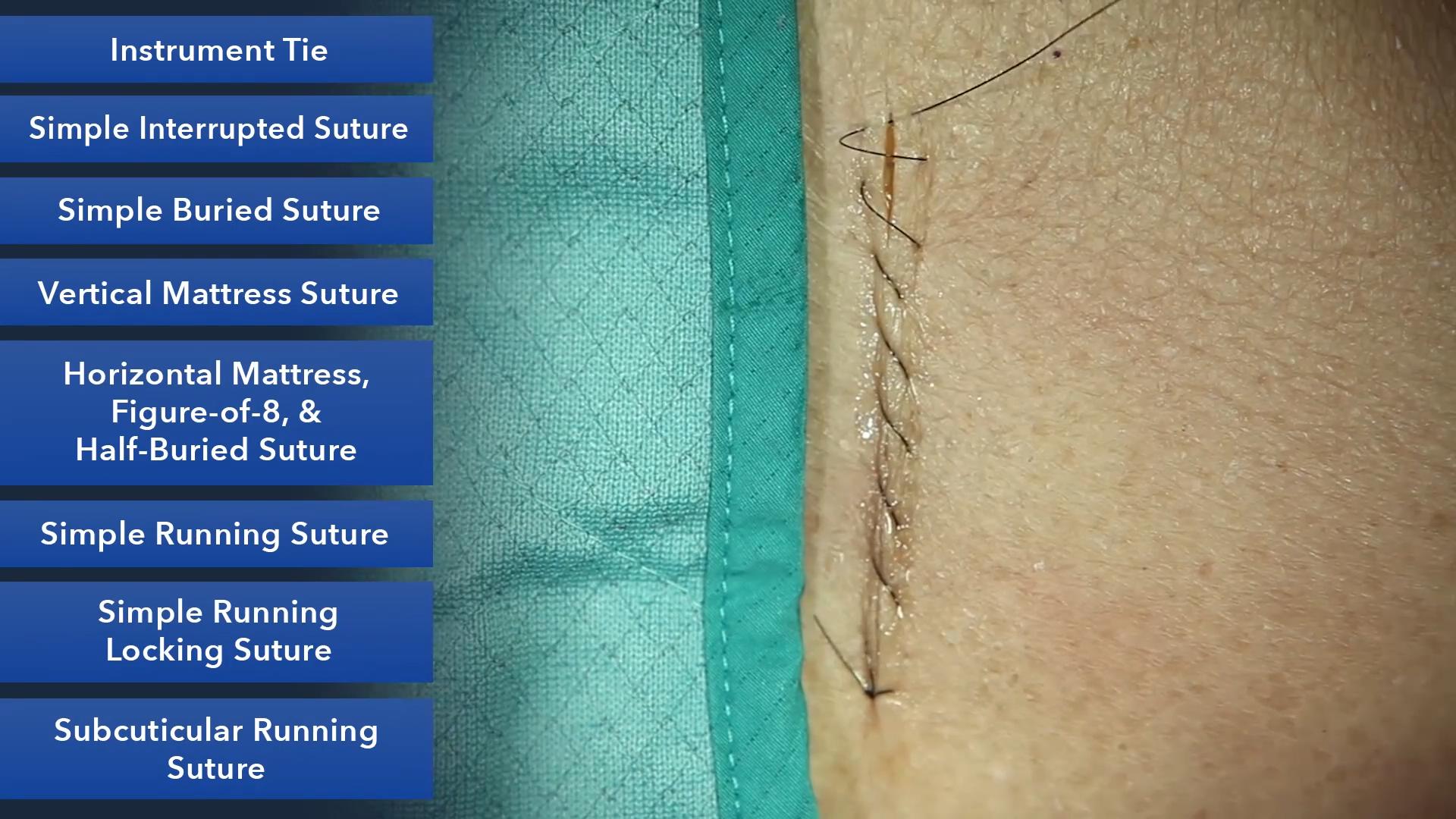 Duke_Suture_Skills_Course_1080p_20210830205934