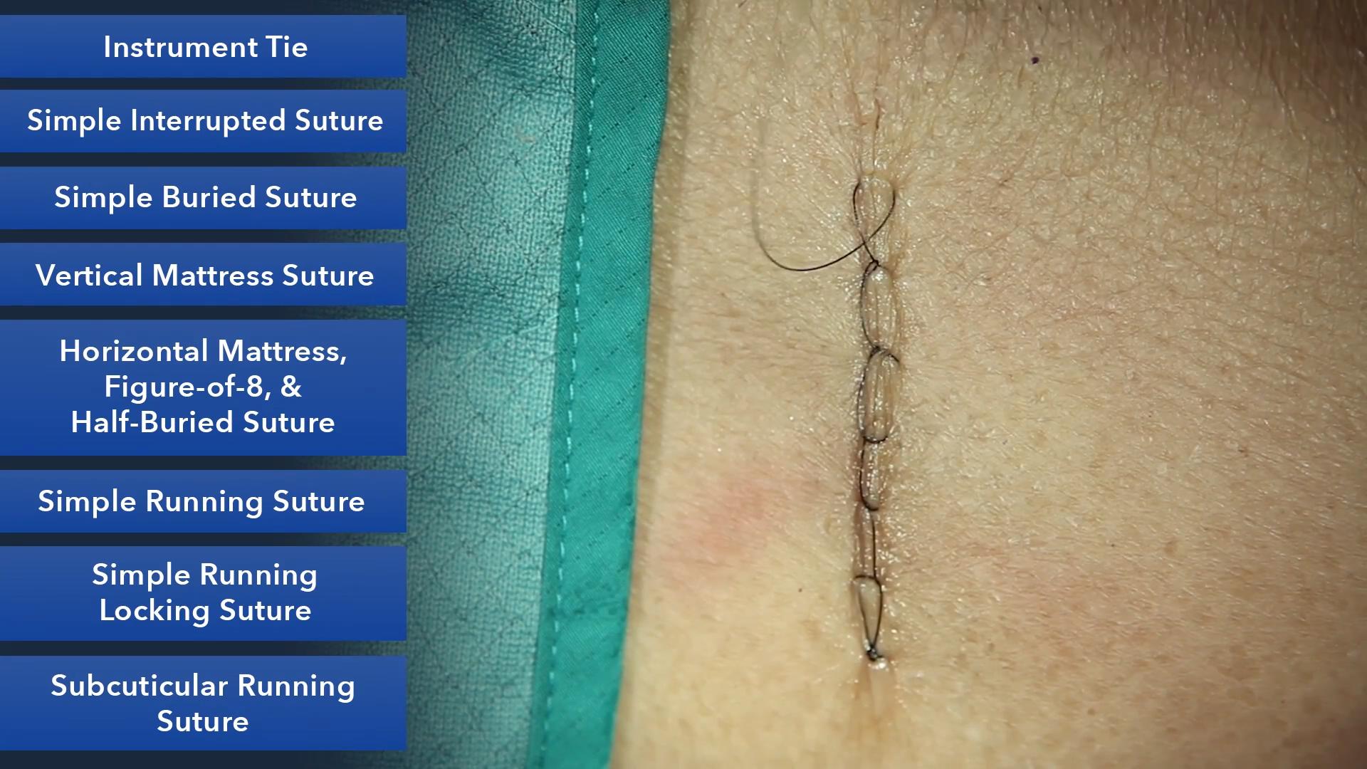 Duke_Suture_Skills_Course_1080p_20210830210737