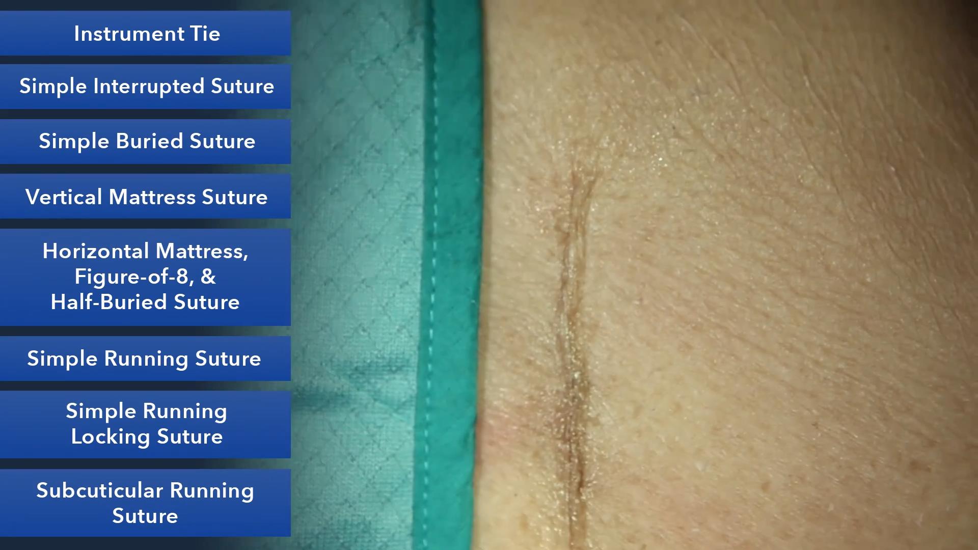 Duke_Suture_Skills_Course_1080p_20210830212203