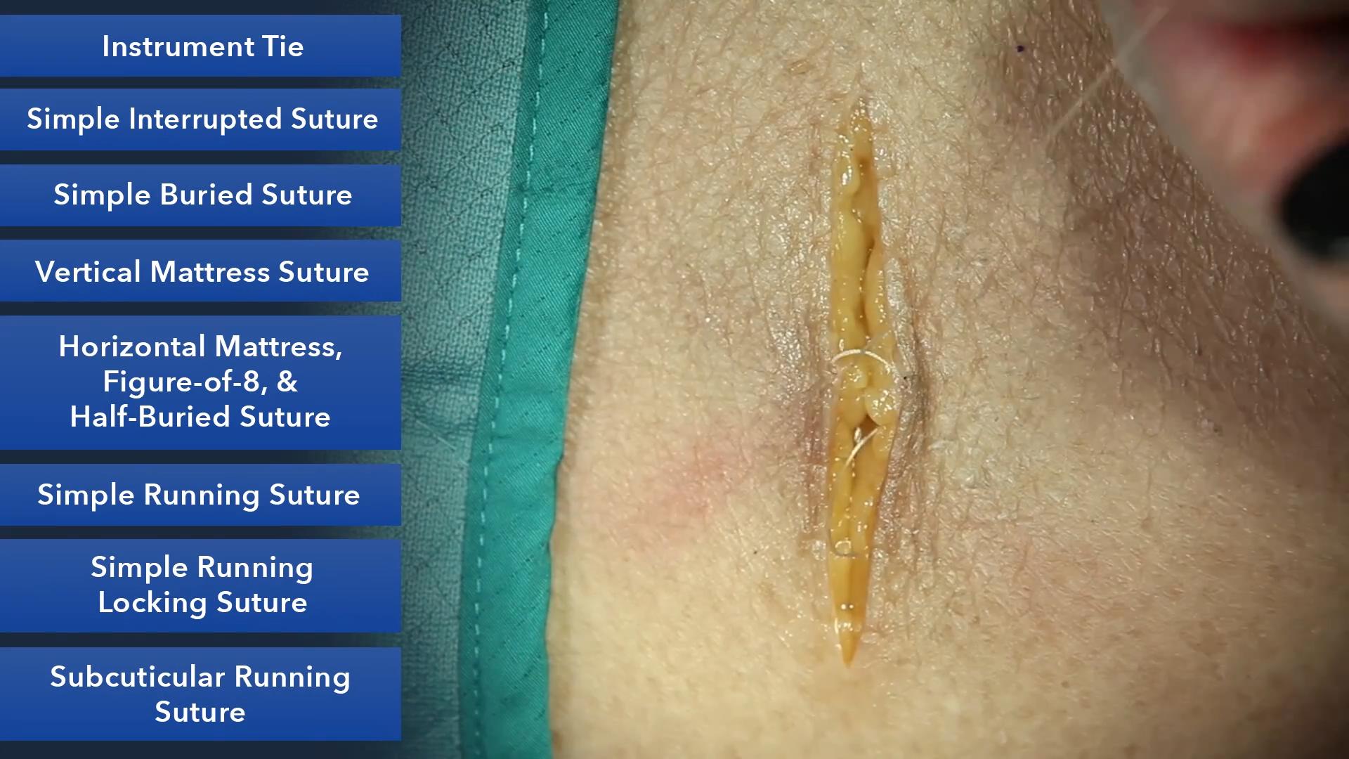 Duke_Suture_Skills_Course_1080p_20210830202345