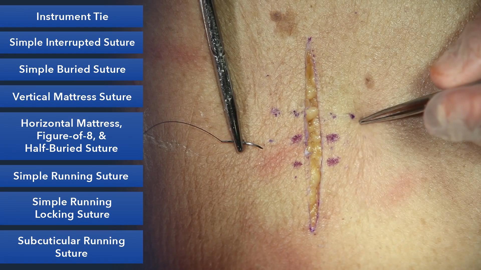 Duke_Suture_Skills_Course_1080p_20210830204531