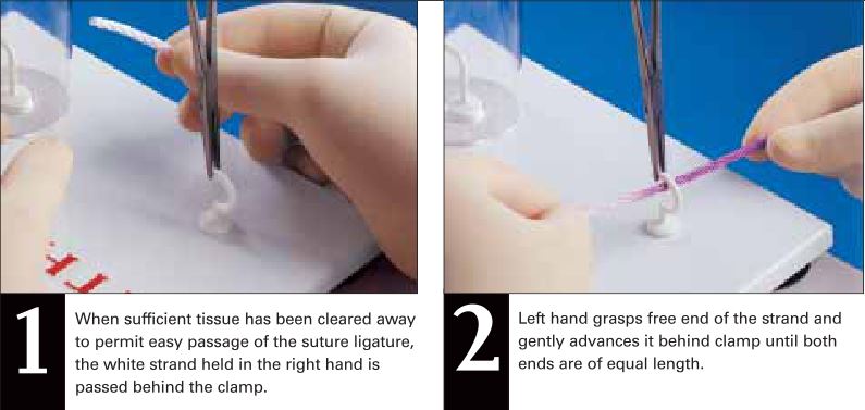 6ligation_around_hemostatic_clamp1